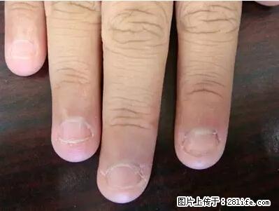 剪指甲、挖耳屎，这些日常小动作竟隐藏大危害！ - 清远生活资讯 - 清远28生活网 qingyuan.28life.net